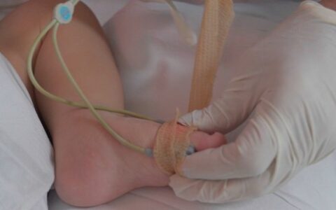 detectar-cardiopatias-congenit