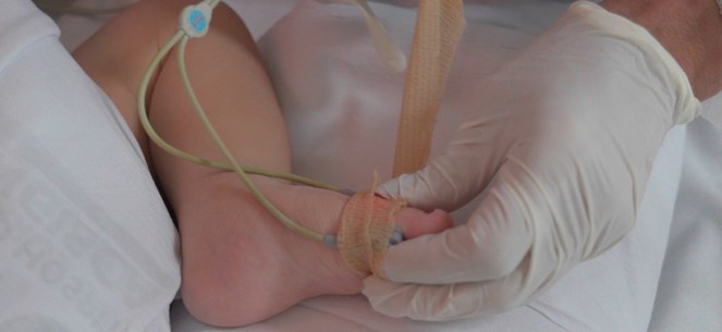 detectar-cardiopatias-congenit