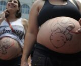 Fatores sociais e estruturais empurram mulheres para cesarianas