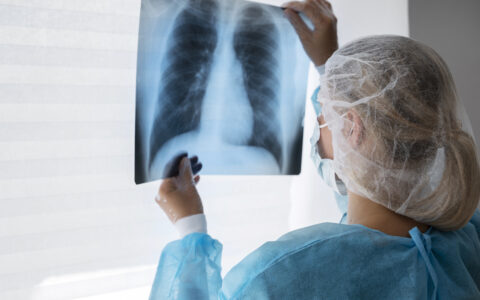 cancer-de-pulmao-diagnostico-t