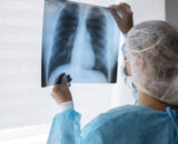 cancer-de-pulmao-diagnostico-t