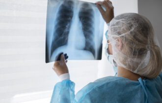 cancer-de-pulmao-diagnostico-t