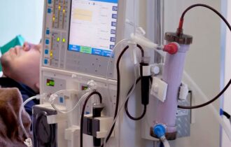 doenca-renal-cronica-e-subdiag