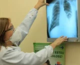 Anvisa autoriza medicamento para câncer de pulmão avançado
