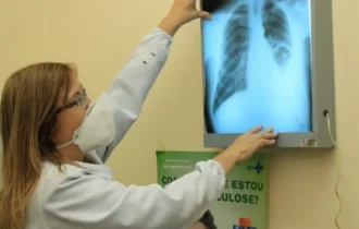 Anvisa autoriza medicamento para câncer de pulmão avançado