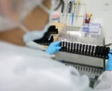 Anvisa libera testes em humanos de vacina nacional contra malária