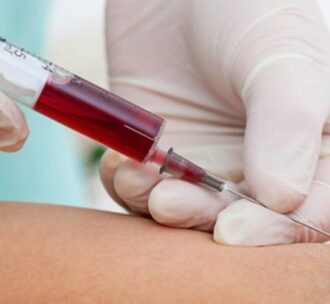 Exame de sangue que pode detectar mais de 50 tipos de câncer chega ao Brasil