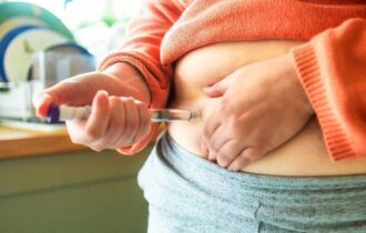 OMS define novas orientações para tratar obesidade em crianças